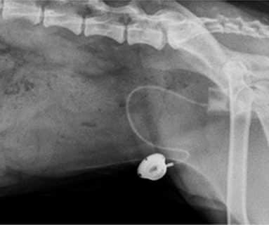 AUS — Artificial Urethral Sphincter — Movora